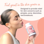 Acne Cleanse – Complément Peau Nette – 90 Capsules – Formule aux Extraits de Plantes (Hamamélis, Saule Blanc) et Vitamines A & C – Aide à Réduire l'Acné et les Imperfections – Cure de 3 mois