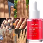 Sérum Correcteur Anti-Taches MÔOYAM – Niacinamide 10% + TXA 4% – 30ml