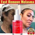 Sérum Correcteur Anti-Taches MÔOYAM – Niacinamide 10% + TXA 4% – 30ml – Image 2