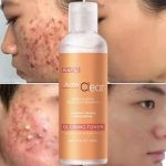 Lotion Tonique Purifiante Acne Clear – Traitement Rapide à l'Acide Salicylique – Élimine l'Acné, Réduit les Marques et Nettoie les Pores – Teint Éclatant et Hydraté – 100ml