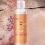 Lotion Tonique Purifiante Acne Clear – Traitement Rapide à l'Acide Salicylique – Élimine l'Acné, Réduit les Marques et Nettoie les Pores – Teint Éclatant et Hydraté – 100ml – Image 5