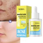 Sérum Anti-Acné à l'Acide Salicylique 2% – Soin Exfoliant et Purifiant (30ml)