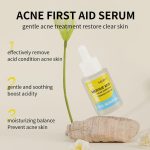 Sérum Anti-Acné à l'Acide Salicylique 2% – Soin Exfoliant et Purifiant (30ml) – Image 3