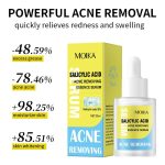 Sérum Anti-Acné à l'Acide Salicylique 2% – Soin Exfoliant et Purifiant (30ml) – Image 4