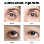 Crème Contour des Yeux au Rétinol – Anti-Cernes, Anti-Poches et Anti-Rides (30g) – Image 5