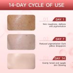 Sérum Correcteur Anti-Tâches – Niacinamide 10% + TXA 4% – Éclat du Teint & Anti-Imperfections – 30ml – Image 3