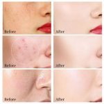 Crème Visage ROYAL – Soin Éclat Instantané à la Poudre de Perle et Acide Hyaluronique – Image 2