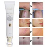 Crème de Réparation Intensive : Vergetures, Cicatrices, Chéloïdes et Marques d'Acné (30g)