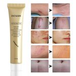 FATAZEN – Crème de Réparation Intensive : Vergetures, Cicatrices, Chéloïdes et Marques d'Acné – Image 5