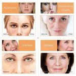 Coffret Routine Éclat MOÔYAM à la Vitamine C – Blanchissant, Hydratant et Anti-Âge – Pack Complet 5-en-1 – Image 4