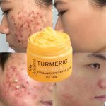 Crème Visage au Curcuma LANEMAY – Éclat Naturel & Anti-Acné – clarifiante et Hydratante (30g)