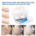 Crème Réparatrice LANEMAY – Formule Avancée pour Marques d'Acné et autres– 50ml – Image 3