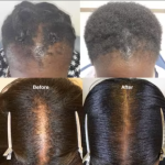 Duo Capillaire LANEMAY : Shampoing & Huile de Batana 100% Non Raffiné – Soin Réparateur pour Cheveux Abîmés – Image 6