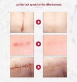 Crème Réparatrice LANEMAY "Scar Disappears" – Soin Intensif Anti-Cicatrices & Vergetures (20g) – Image 5