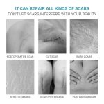 Crème Réparatrice LANEMAY "Scar Disappears" – Soin Intensif Anti-Cicatrices & Vergetures (20g) – Image 6