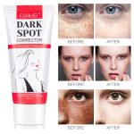 ELAIMEI/RG Dark Spot Corrector – Soin Clarifiant Anti-Taches pour le Visage - 60ml – Image 3