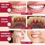 Dentifrice SP-4 ELAIMEI Ultra+ – Blanchiment Éclatant & Soin Probiotique Complet (120g) – Image 4