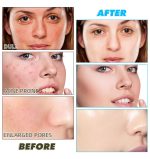 Disques Nettoyants au Curcuma & Acide Kojique – Éclat du Teint, Anti-Imperfections et Exfoliation Douce (50 pièces) – Image 3