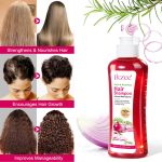 Shampoing ikzee à l'Oignon et au Romarin – Enrichi à la Biotine – Soin fortifiant contre la chute et pour la pousse des cheveux (250 ml) – Image 4