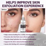 Ampoule Exfoliante ikzee au Riz Noir – Soin Anti-Imperfections, Pores Affinés et Renouvellement Cellulaire (100ml) – Image 3
