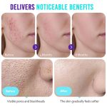 Ikzee - Onion Glow Renewal Hydrating Pads (60 pads) : Soin exfoliant et hydratant à 82% d'extrait d'oignon pour une peau éclatante et unifiée – Image 3