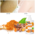 Lotion Corporelle Clarifiant au Curcuma et Acide Kojique (300ml) – Anti-Taches, Hydratation Intense et Protection SPF 50 – Pour une Peau Lisse et Éclatante – Image 6