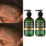 Duo Lanemay à l'Huile de Batana – Shampooing & Après-Shampooing Fortifiants - Anti-Chute et Croissance Cheveux
